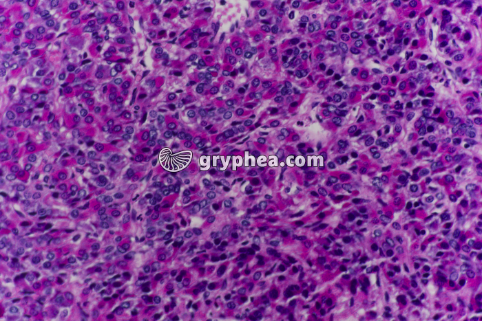 Hypophyse antérieure x100 - gryphea.com